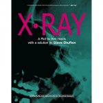 (image for) X-Ray by Ben Harris and Steve Shufton - Book